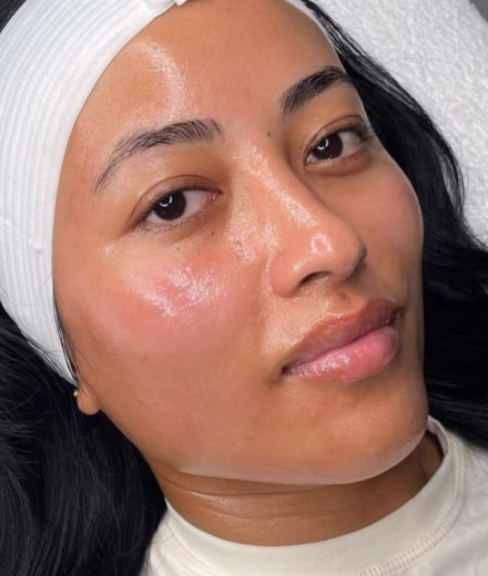 Testimonio de Sofía, paciente de Dermaplaning en Bogotá