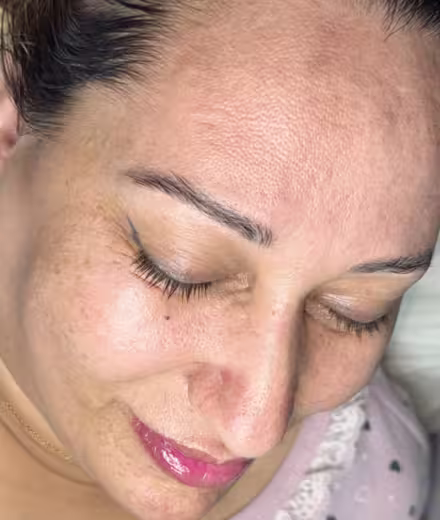 Testimonio de Valeria sobre tratamiento CASMARA en Bogotá