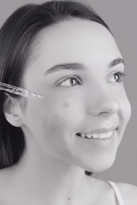Tratamiento combinado con Nanopore para cicatrices de acné