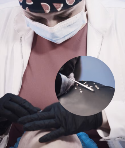 Protocolo personalizado de limpieza facial medicalizada