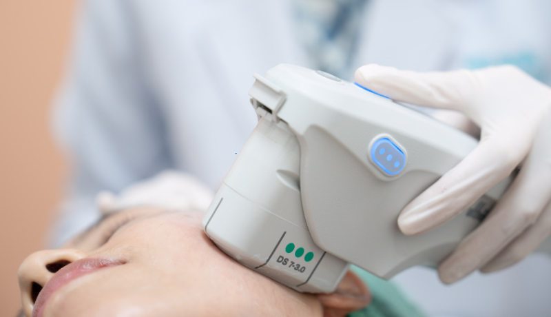 Mujer sonriente mostrando los resultados de Ultherapy, tratamiento de lifting sin cirugía en Bogotá